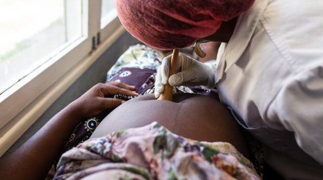  FISTULE OBSTETRICALE : Un fléau silencieux qui emprisonne des milliers de femmes